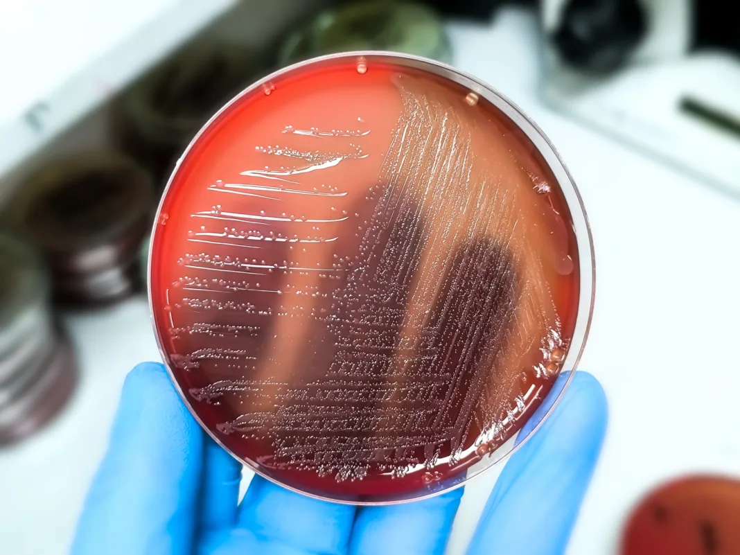 Brote de salmonela causa 9 hospitalizados: ¿tiene relación con los pepinos de Florida?