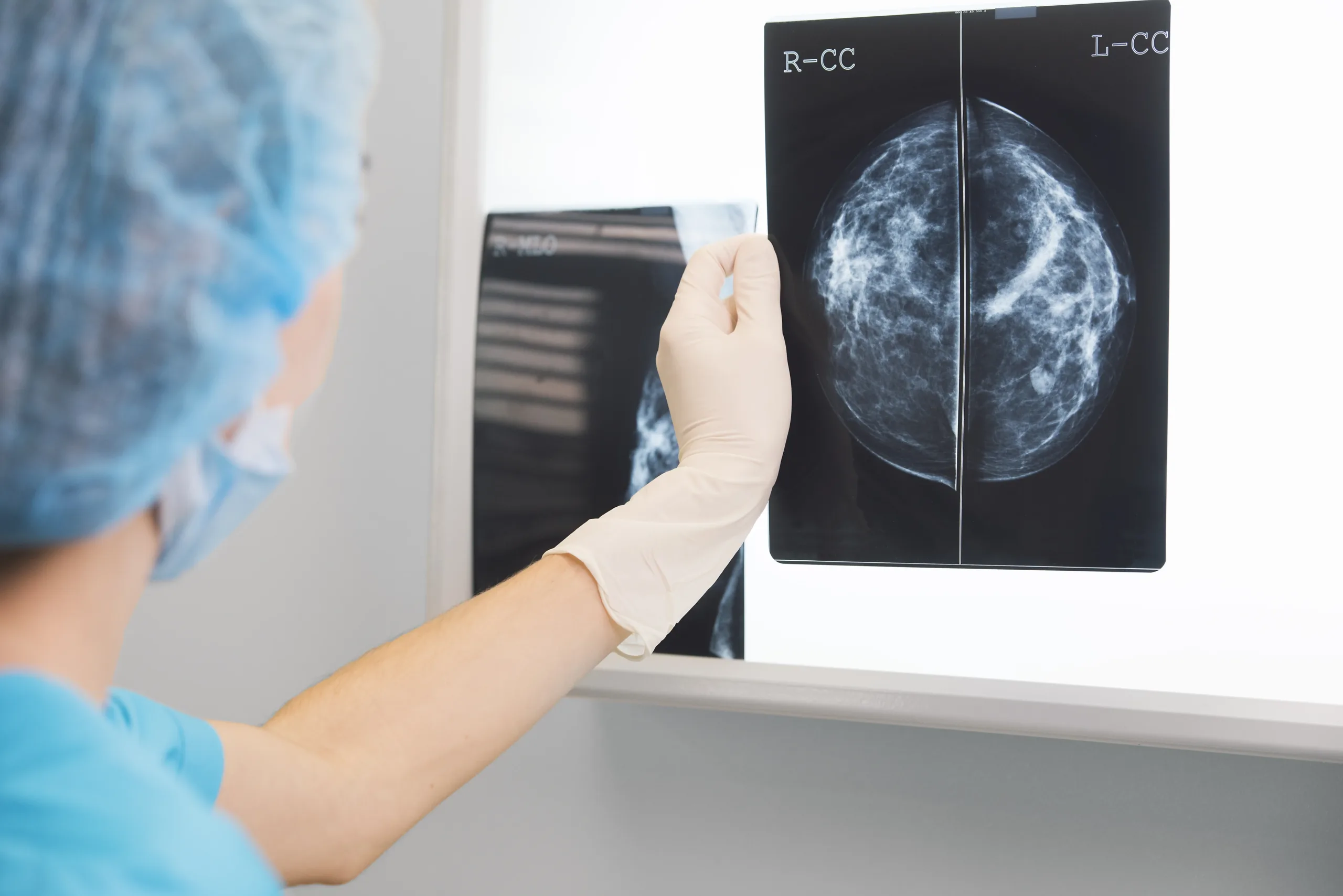 Buenas noticias: muertes por cáncer bajan un 34% en EE.UU.