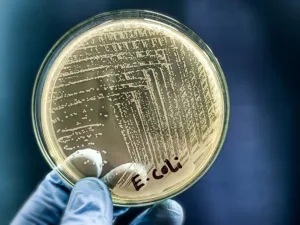 Salud en riesgo: Advierten sobre carne molida contaminada con E.coli