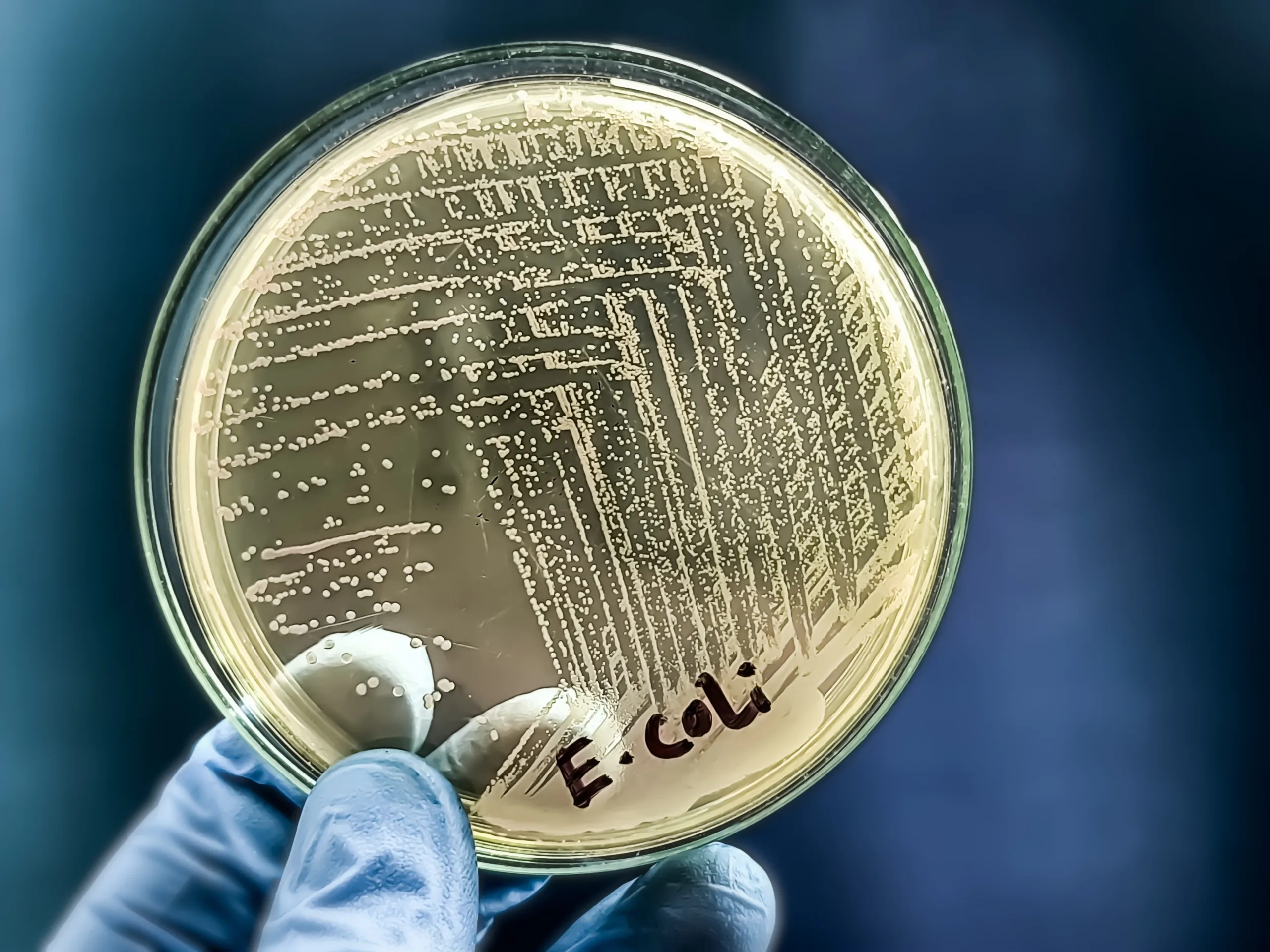 Salud en riesgo: Advierten sobre carne molida contaminada con E.coli - ¿Quieres celebrar el 4 de julio en la costa? Cierran playas por bacterias peligrosas