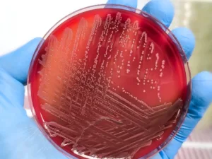 Riesgo en tu cocina: FDA emite advertencia urgente por tomates contaminados