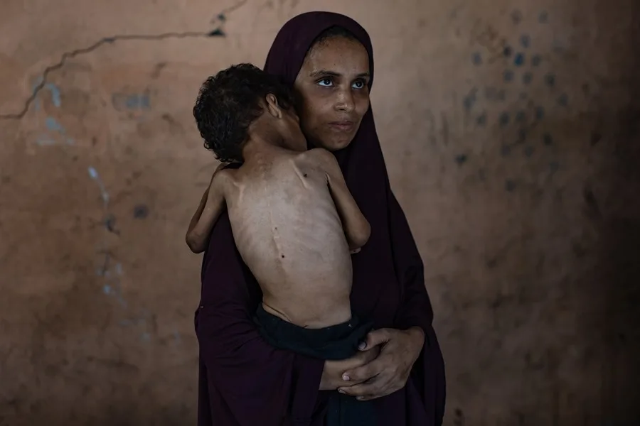 Gaza sin comida: Hambruna provocada por Israel mata a bebés